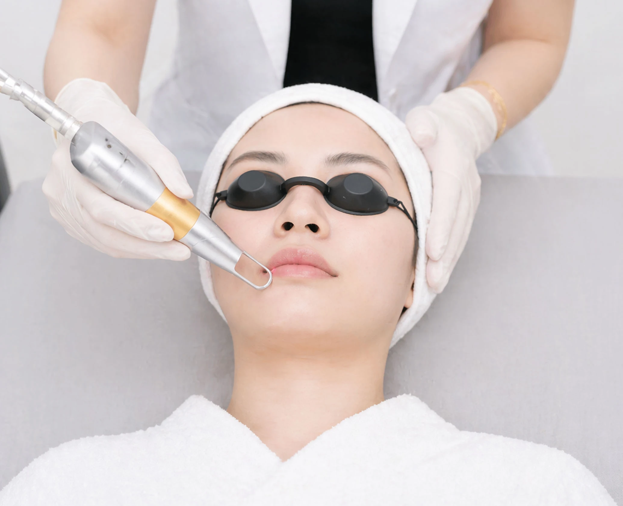 Solusi Bibir Gelap & Mata Panda: Laser Pico | Kusuma Beauty Clinic