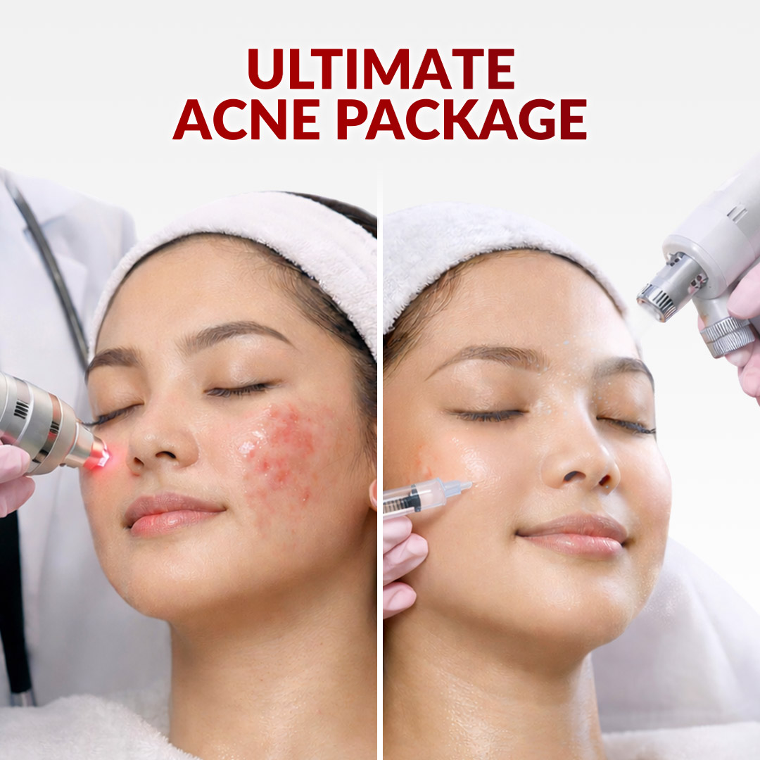 Ultimate Acne Package