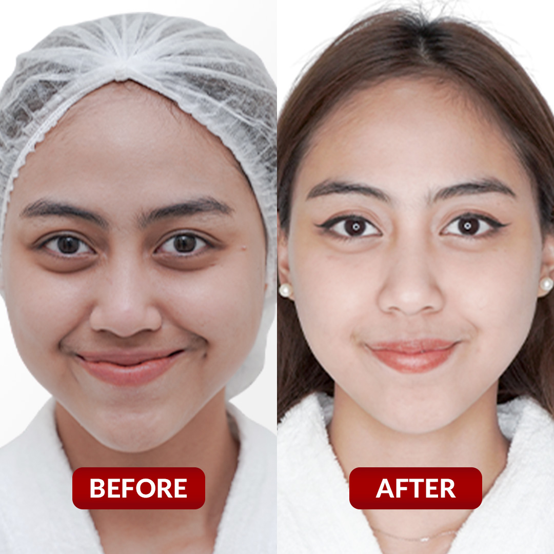 Before After Perawatan 2