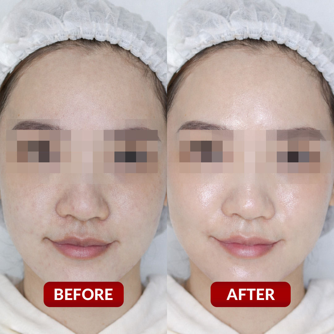 Before After Perawatan 3