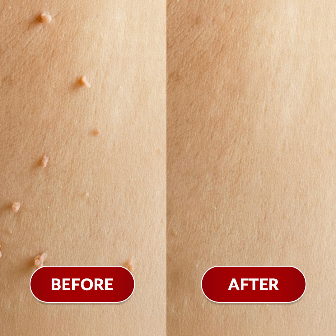 Before After Perawatan 1