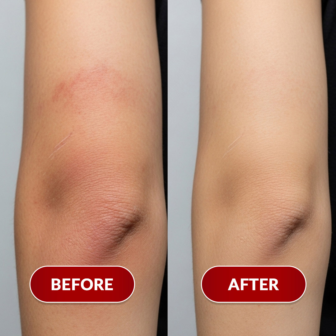 Before After Perawatan 2