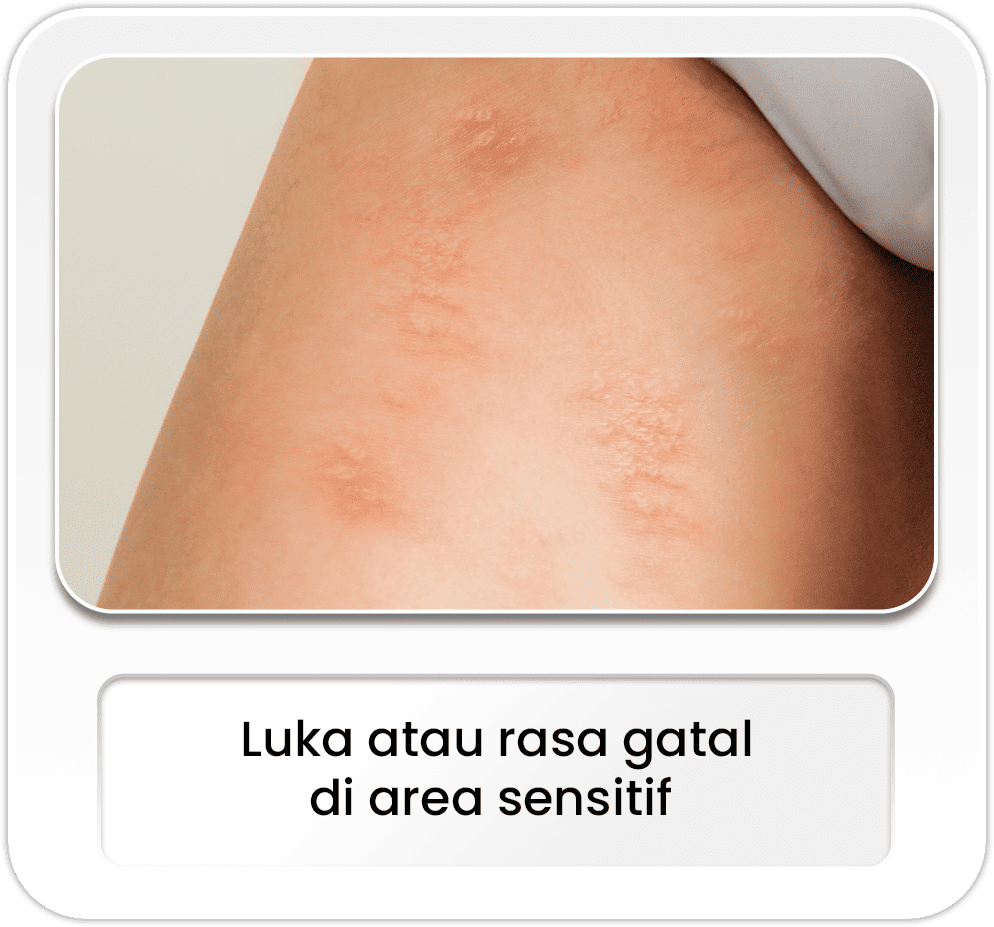 Luka atau rasa gatal di area sensitif
