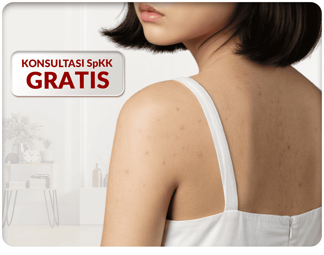 Kusuma Beauty Clinic Konsultasi SpKK Mobile