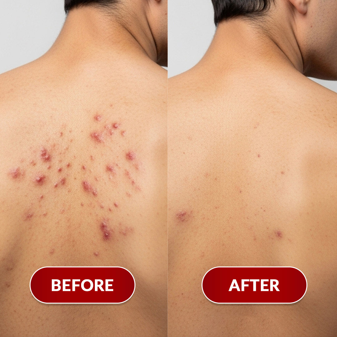 Before After Perawatan 1