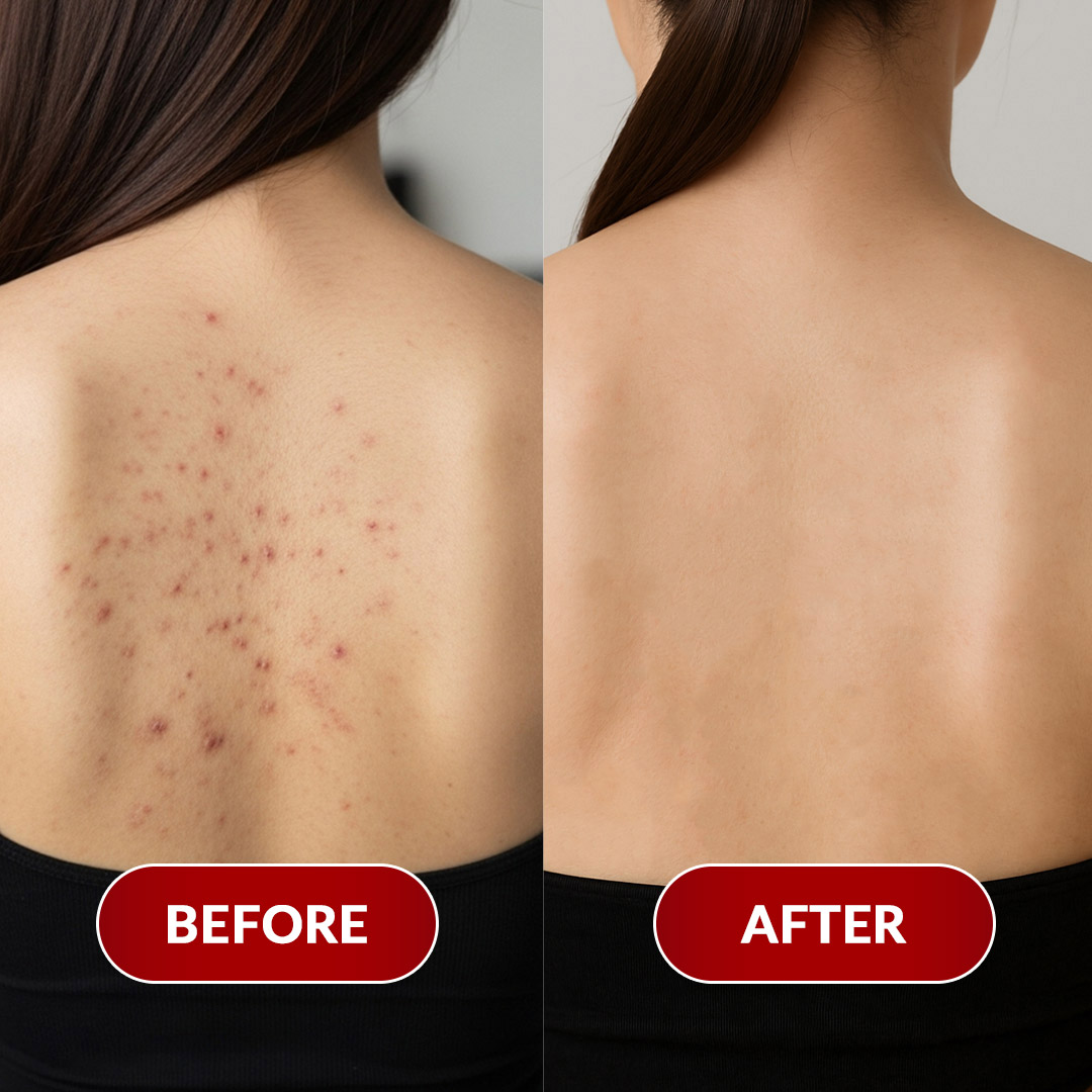 Before After Perawatan 2