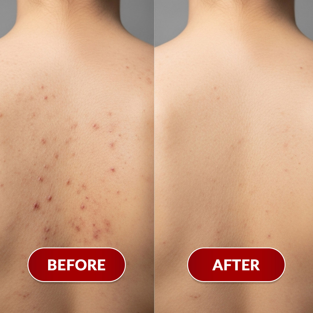 Before After Perawatan 3