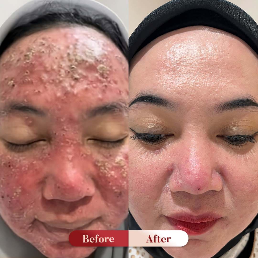 Before After Perawatan 3