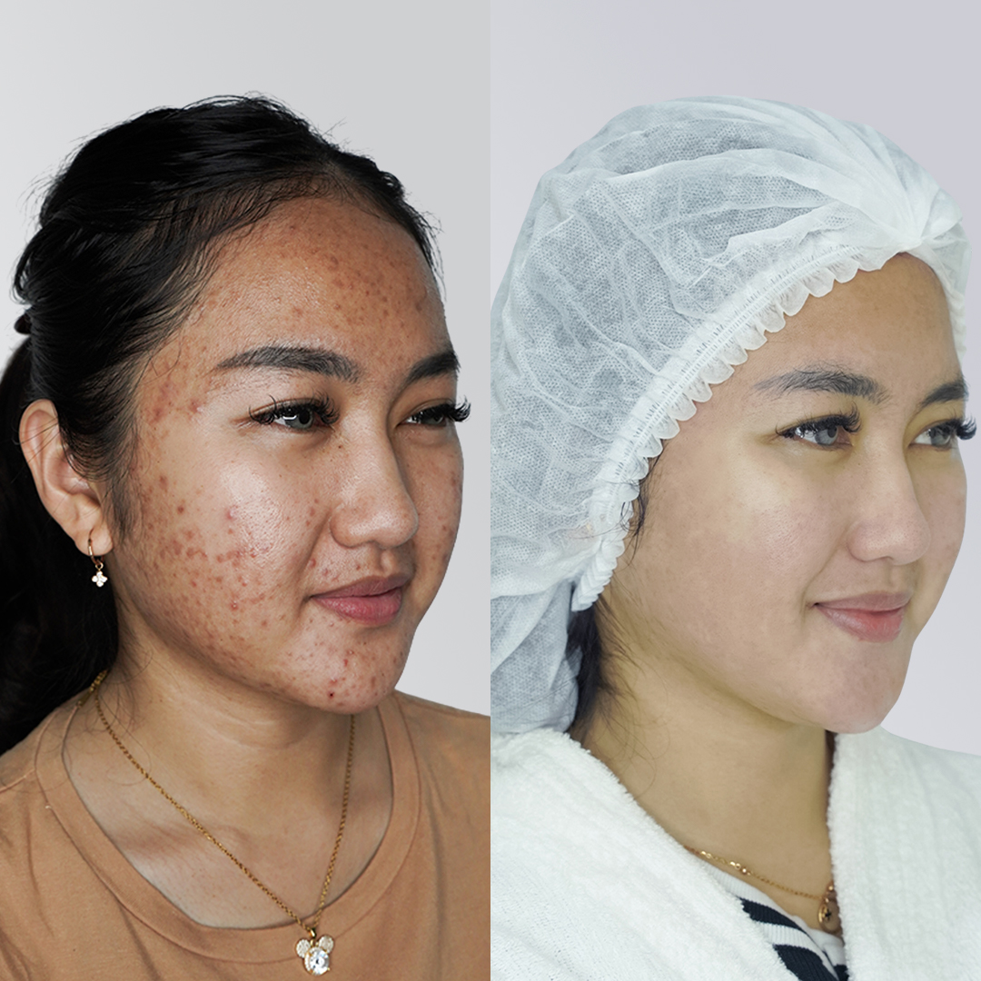 Before After Perawatan 2