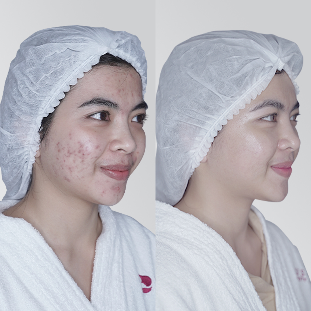 Before After Perawatan 3