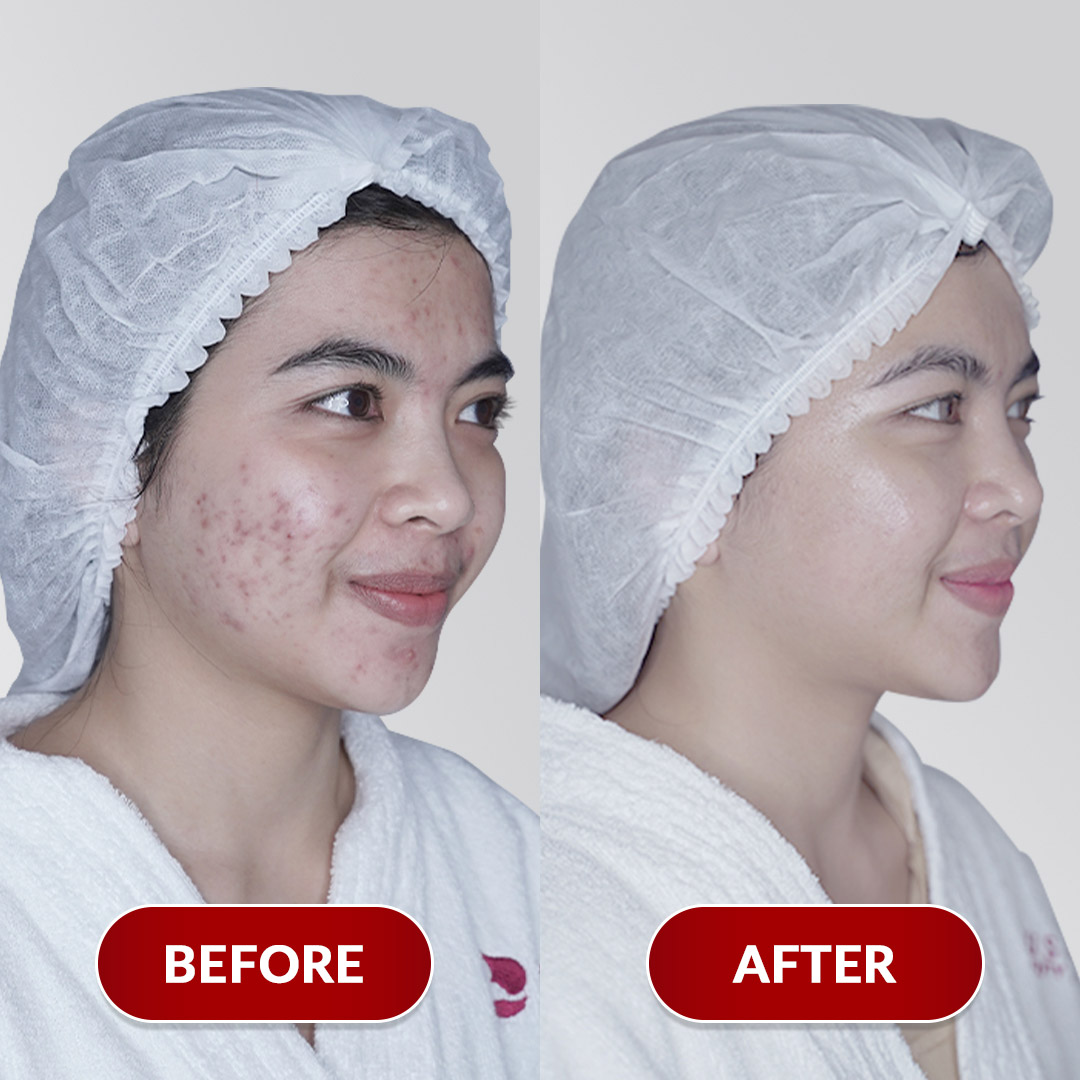 Before After Perawatan 1