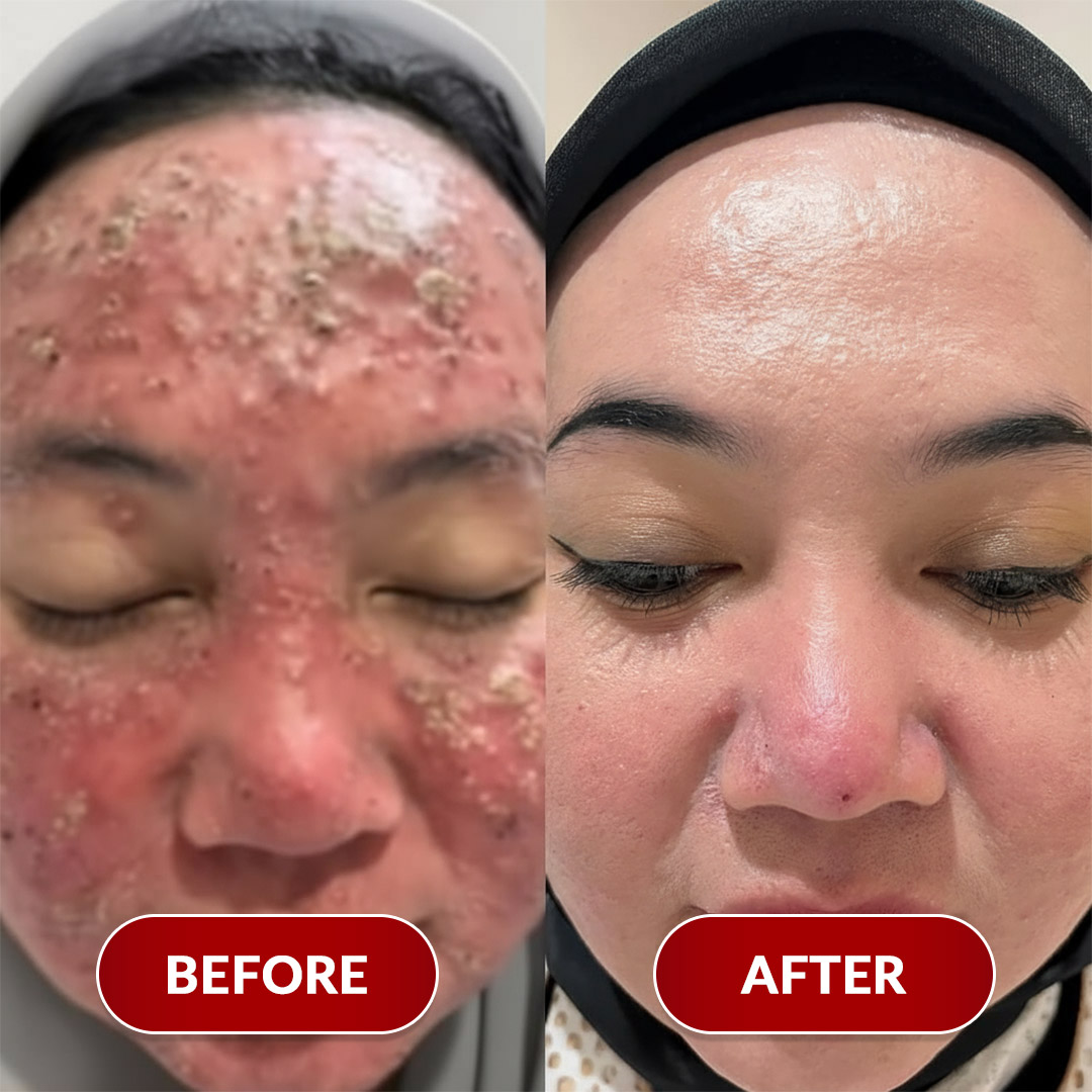 Before After Perawatan 2