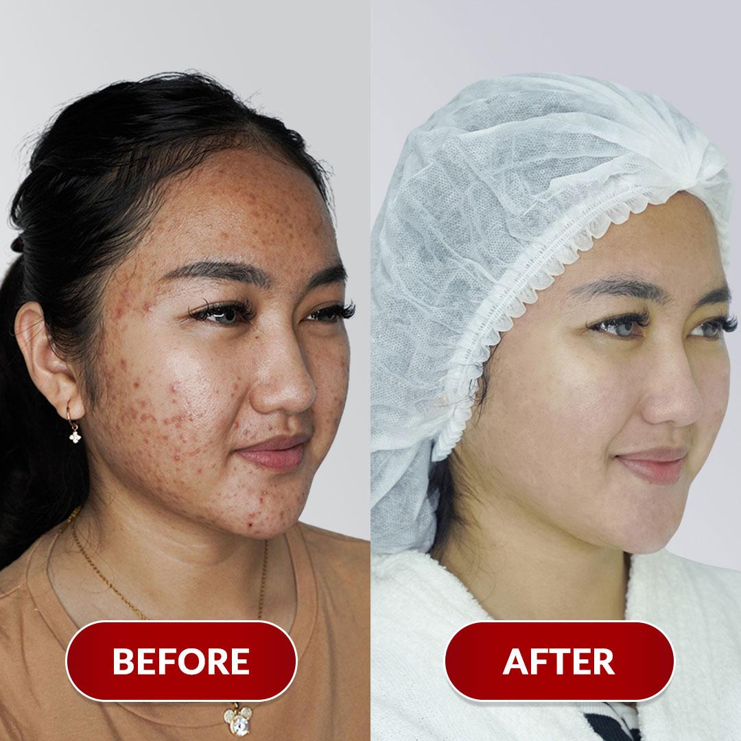 Before After Perawatan 3