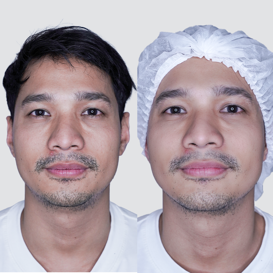 Perawatan 2