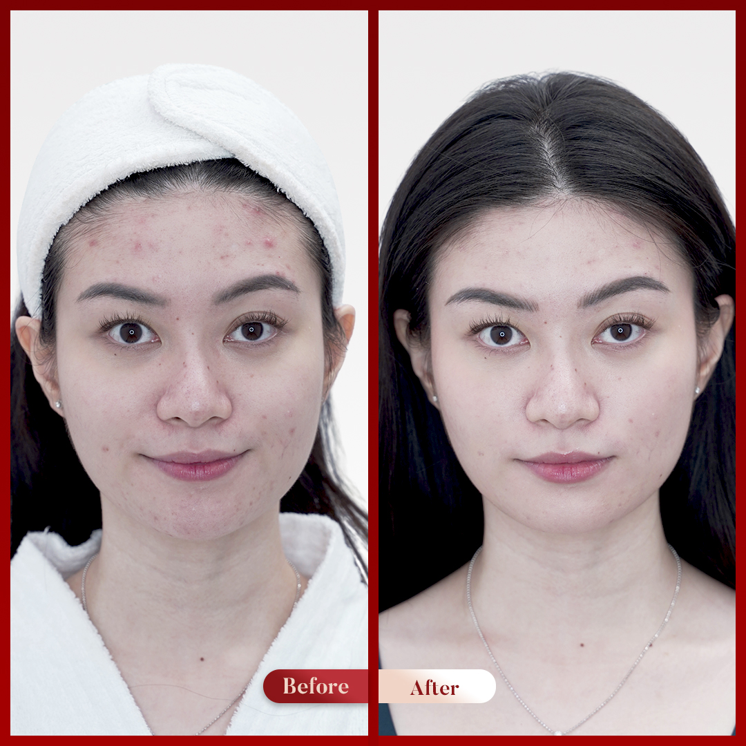 Before After Perawatan 1