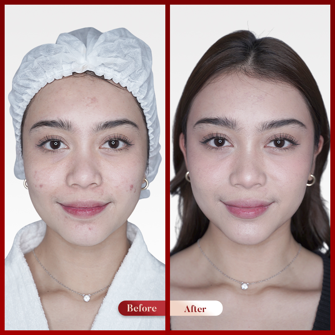 Before After Perawatan 2