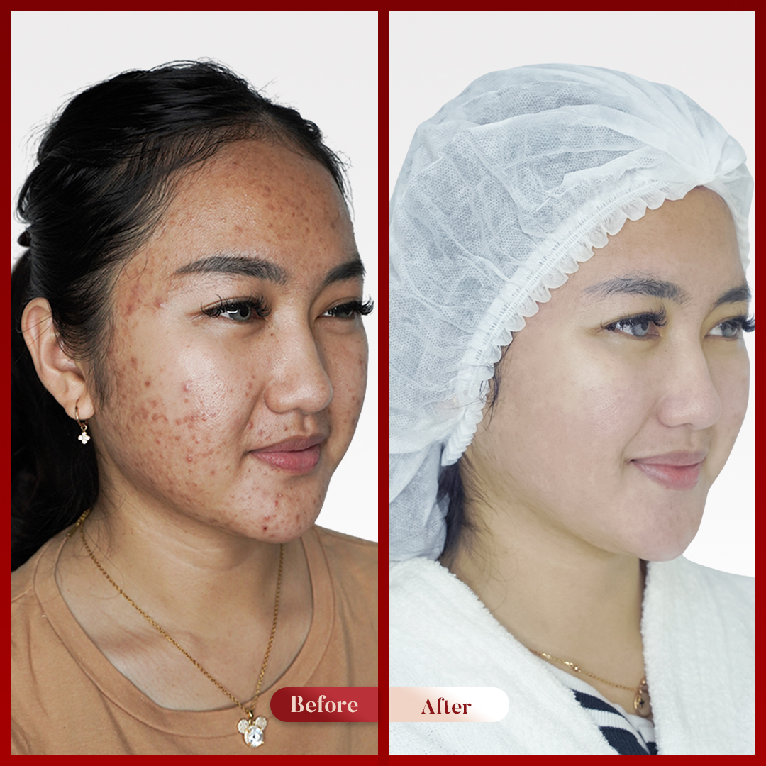 Before After Perawatan 3