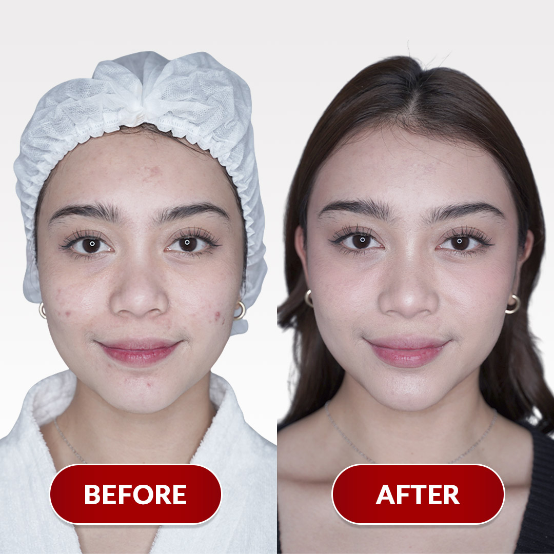 Before After Perawatan 1