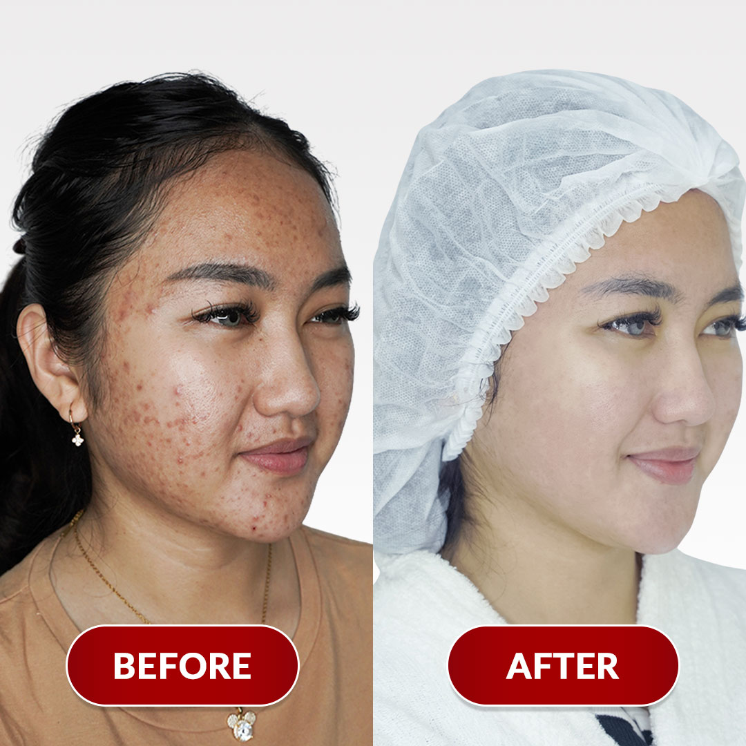 Before After Perawatan 2