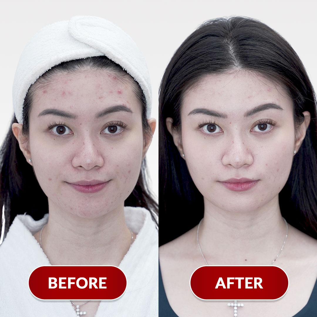 Before After Perawatan 3