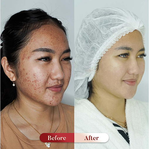 Before After Perawatan 2