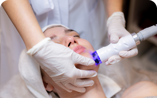 Laser Signature Acne Cure
