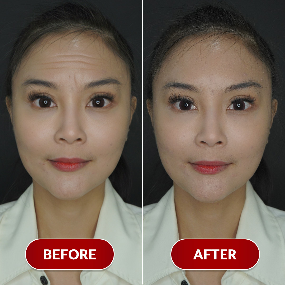 Before After Perawatan 1