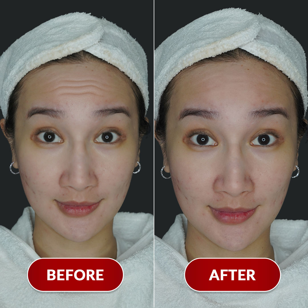 Before After Perawatan 2