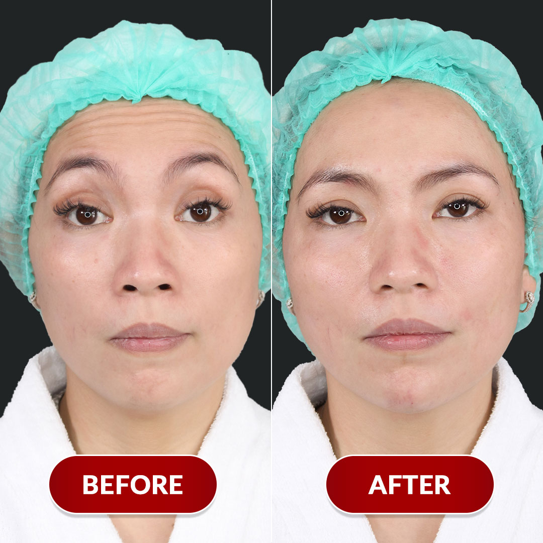 Before After Perawatan 3