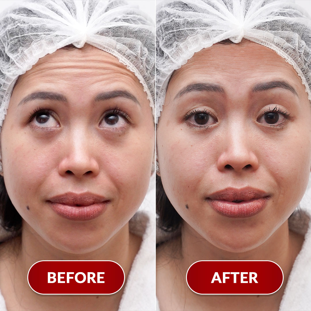 Before After Perawatan 4