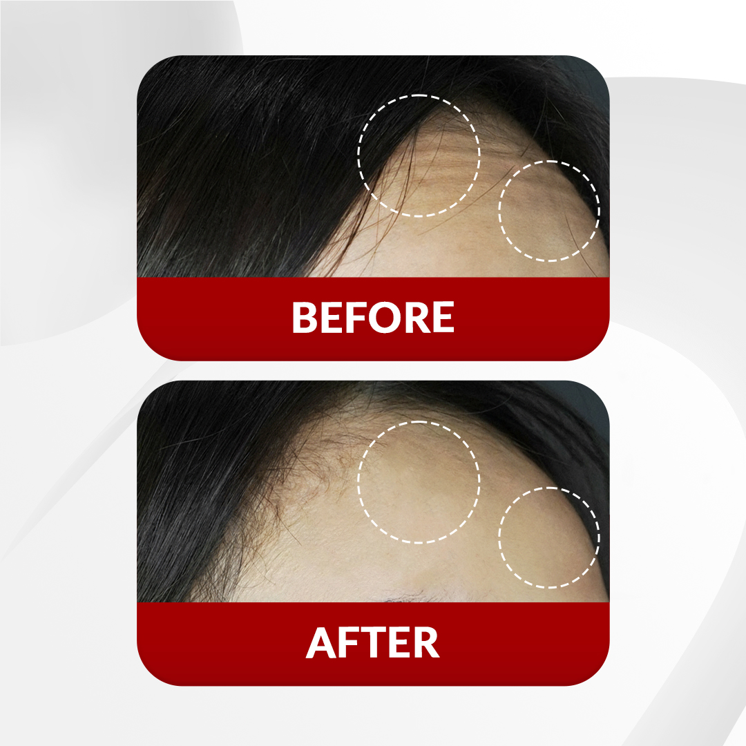 Before After Perawatan 1