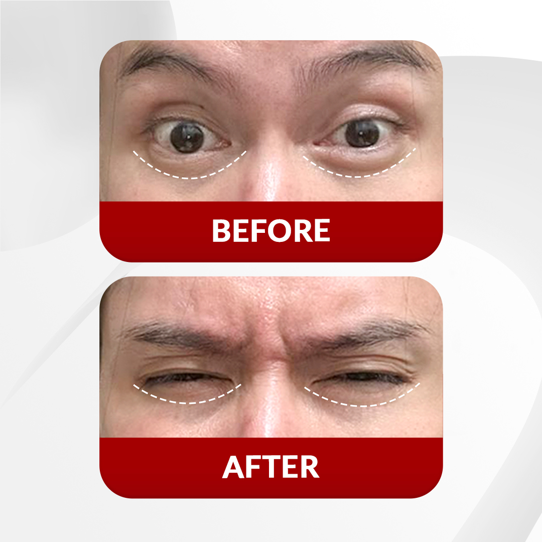 Before After Perawatan 2