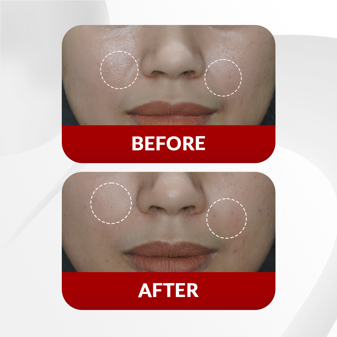 Before After Perawatan 3