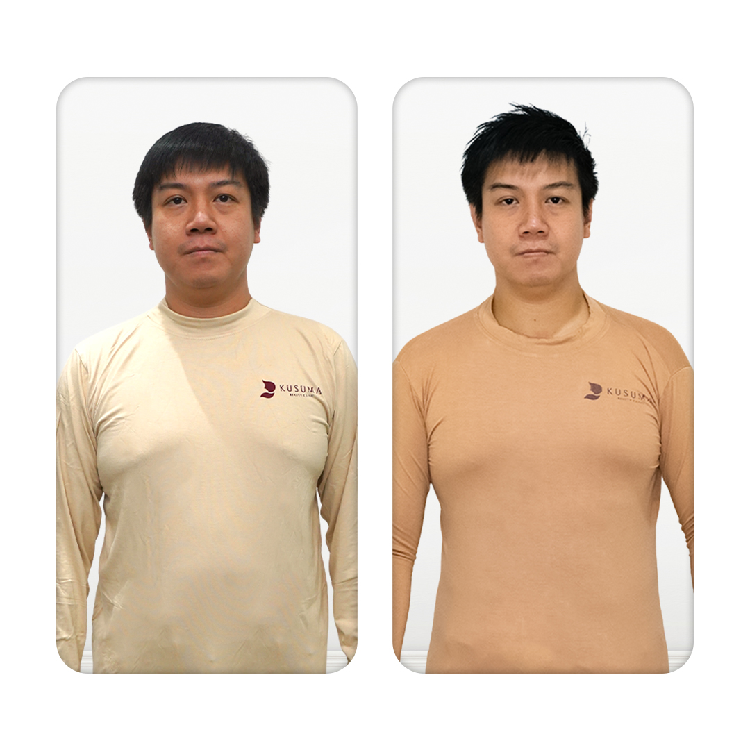 Before After Perawatan 1