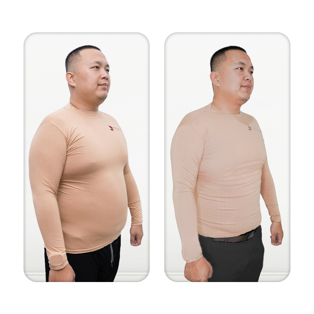 Before After Perawatan 2