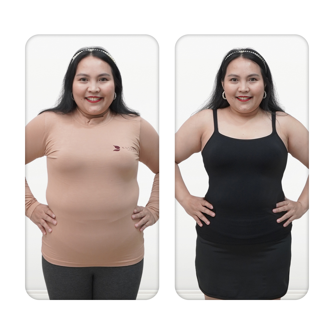 Before After Perawatan 3
