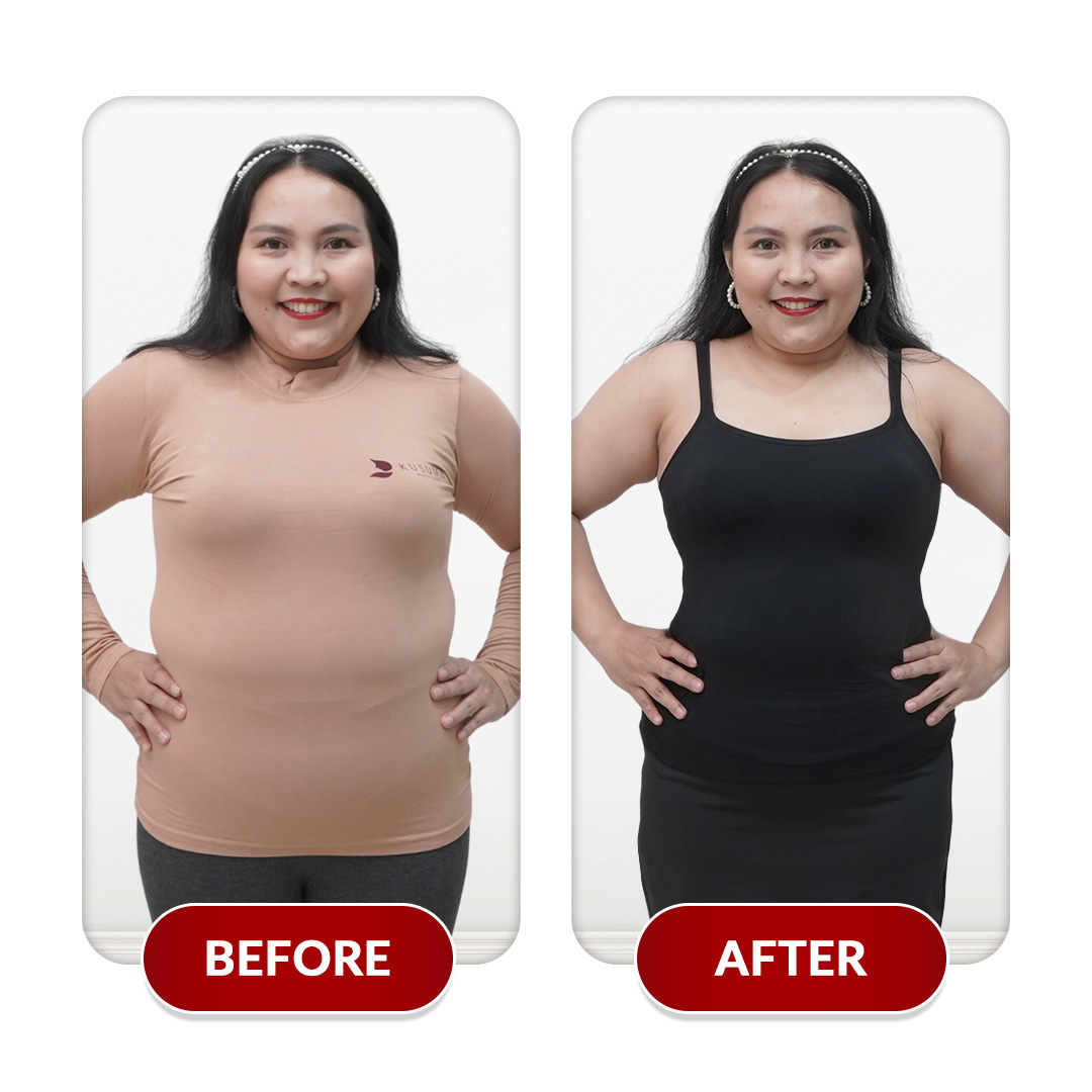 Before After Perawatan 2