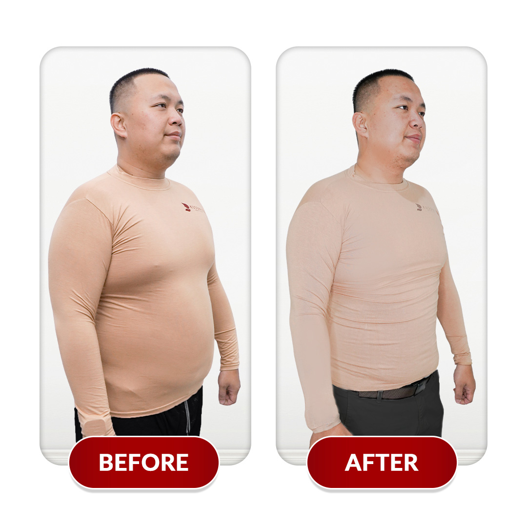 Before After Perawatan 3