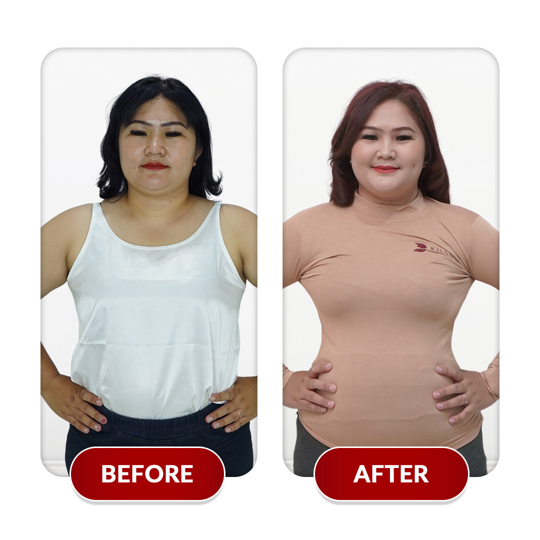 Before After Perawatan 4